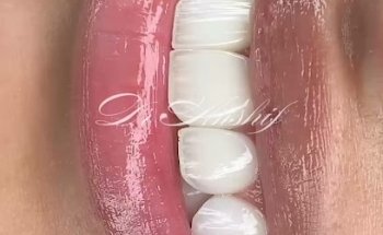 Al Arabi Dental Surgery & Implant Center, مركز العربي لجراحة وزراعة الأسنان - عيادات أسنان في رأس الخيمة