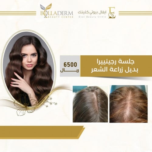 الحوراء بيوتى سنتر - زراعة الشعر في القليوبية