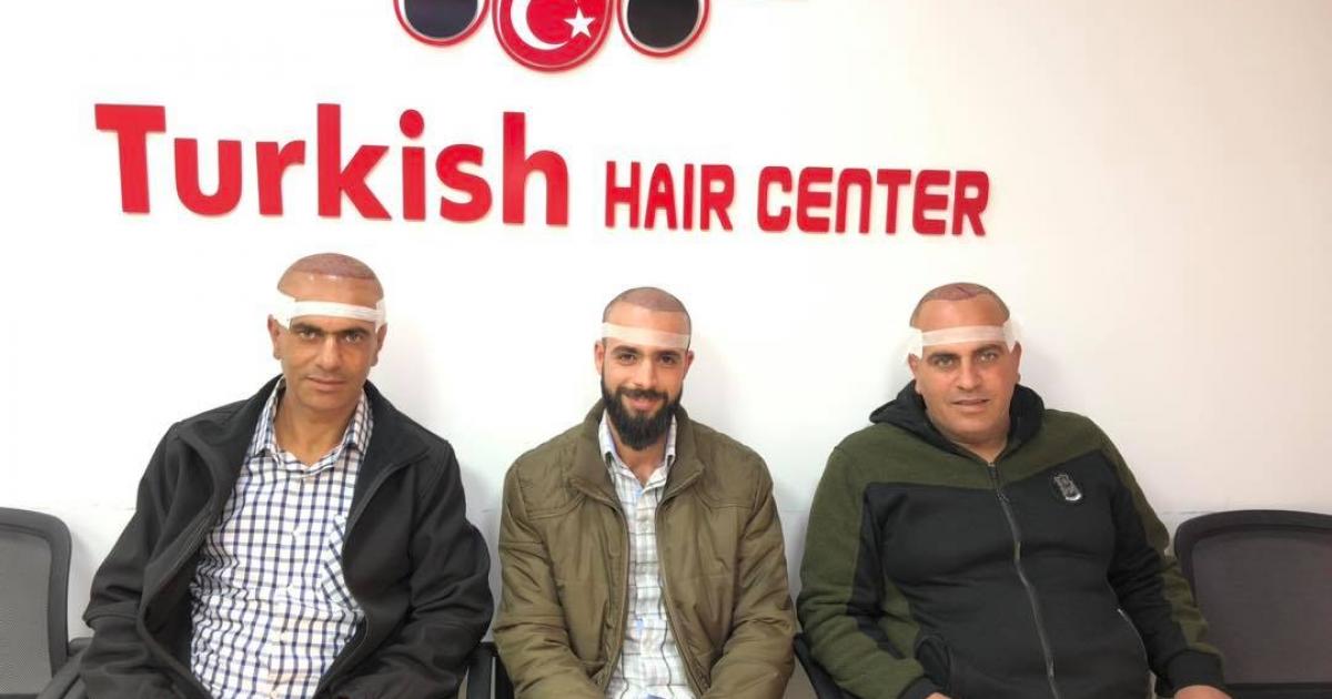 المركز التركي لزراعة الشعر والتجميل رام الله الماصيون Turkish Hair Center - زراعة الشعر في الكرك