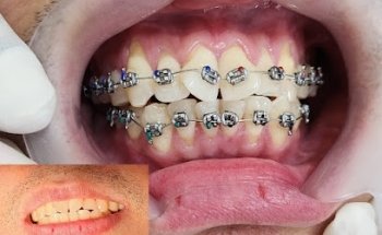 Altamayoz Dental Center Rak - عيادات أسنان في رأس الخيمة