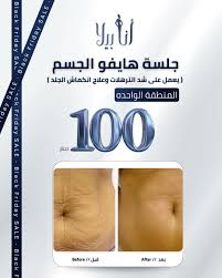 Anabella beauty Company - مراكز تجميل في عمان