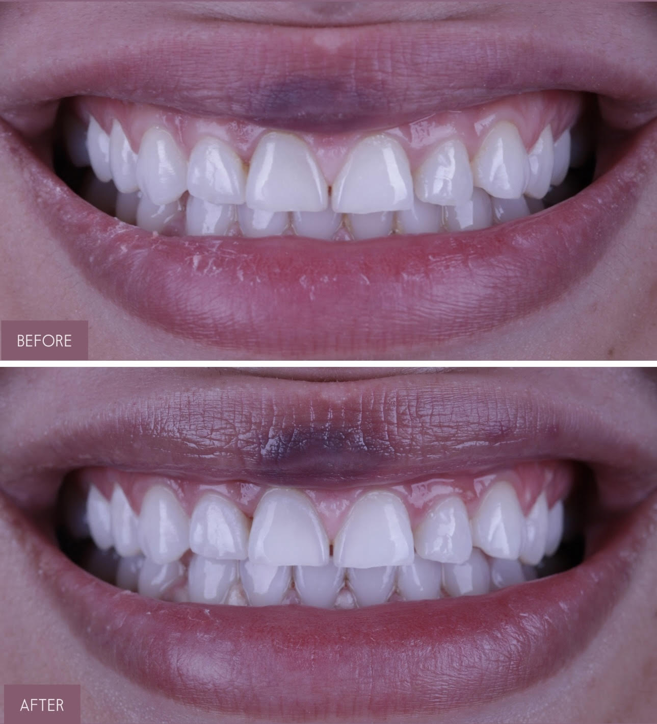 عيادة الابتسامة لطب الاسنان - عيادات أسنان في رأس الخيمة