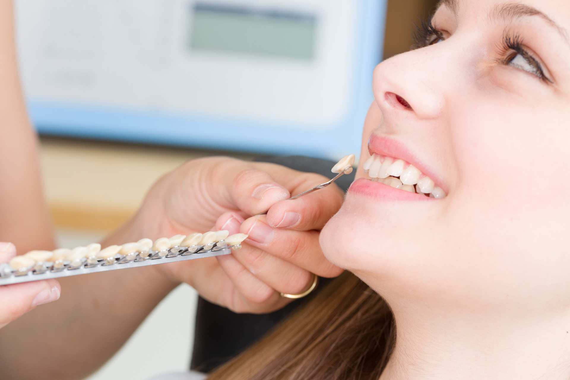 عيادة الاتقان لطب الاسنان - عيادات أسنان في الشارقة