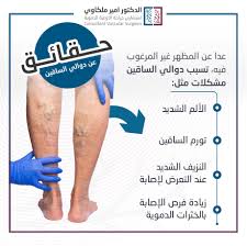 عيادة الدكتور أمير ملكاوي لدوالي الساقين و الأوعية الدموية - عيادات في عمان
