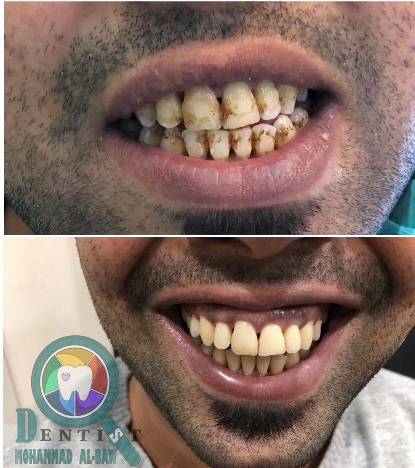 عيادة الدكتور محمد البو - طوارئ اسنان ٢٤ ساعة- زراعة الاسنان - عيادات في عمان