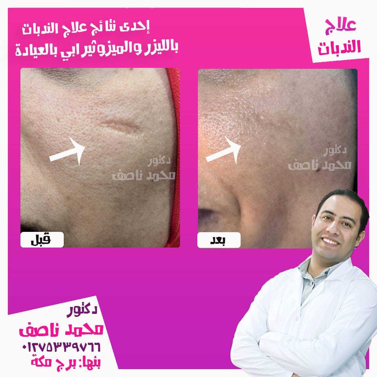 عيادة الدكتور محمد ناصف للامراض الجلدية و التجميل و الليزر - مراكز تجميل في القليوبية