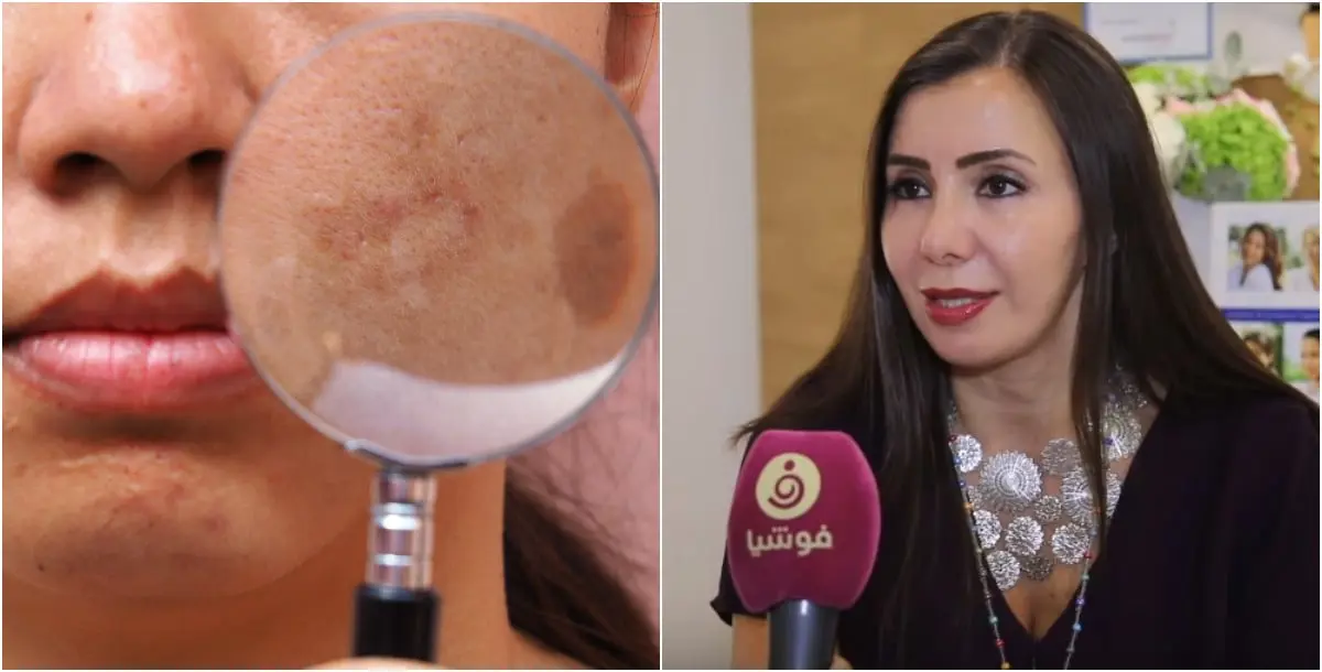 عيادة الدكتورة شدن الشمري - عيادات جلدية في النجف