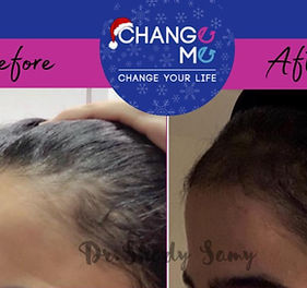 عيادة المثنى للتجميل والليزر - زراعة الشعر في النجف