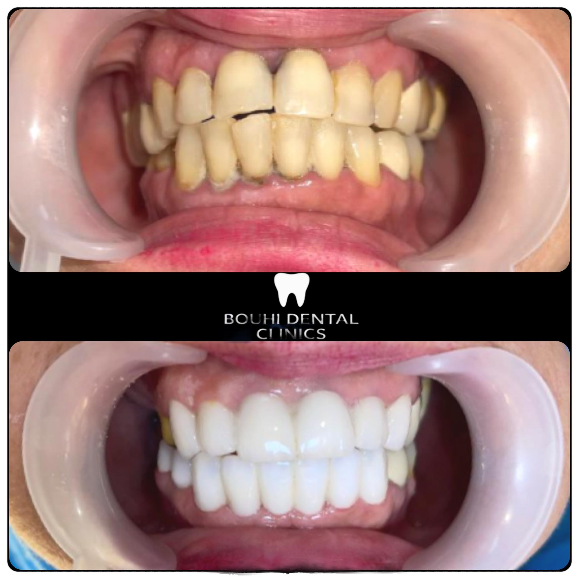 عيادة اسنان شريف البوهي - زراعة الشعر في السويس