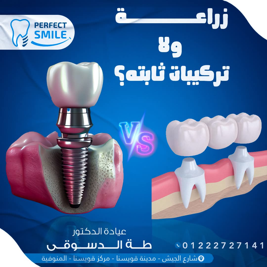 عيادة بيرفكت سمايل لتقويم و زراعة الاسنان د/ طه الدسوقي - عيادات أسنان في دمنهور