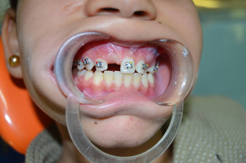 عيادة د حماده الشيخ لطب وجراحة الفم والأسنان وجراحات الوجه والفكين - عيادات أسنان في قنا