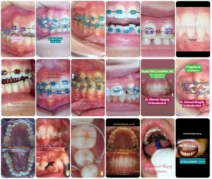 عيادة د. محمد عادل أبوغنيمه لطب و تقويم وتجميل الاسنان - عيادات أسنان في البحيرة