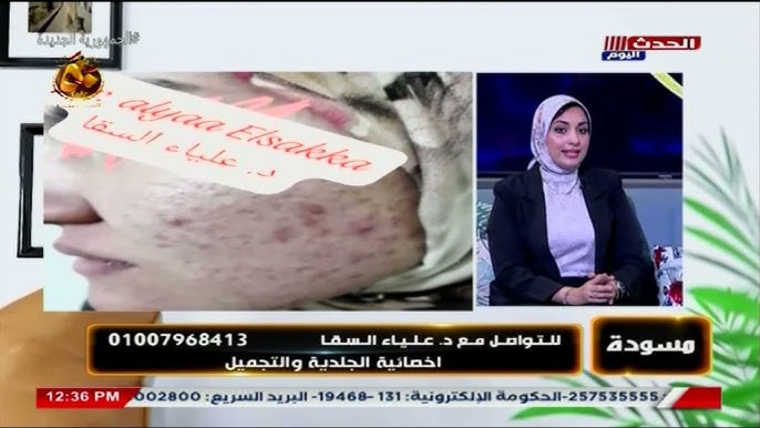 عيادة دكتورة علياء السقا جلدية و تجميل و ليزر - عيادات جلدية في الإسكندرية