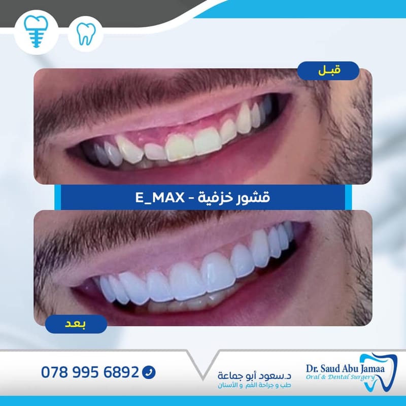 عيادات السقا لطب وجراحة الفم والاسنان - عيادات أسنان في الفيوم