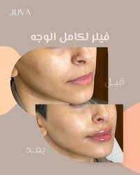 عيادات جوفا - عيادات في الوجه