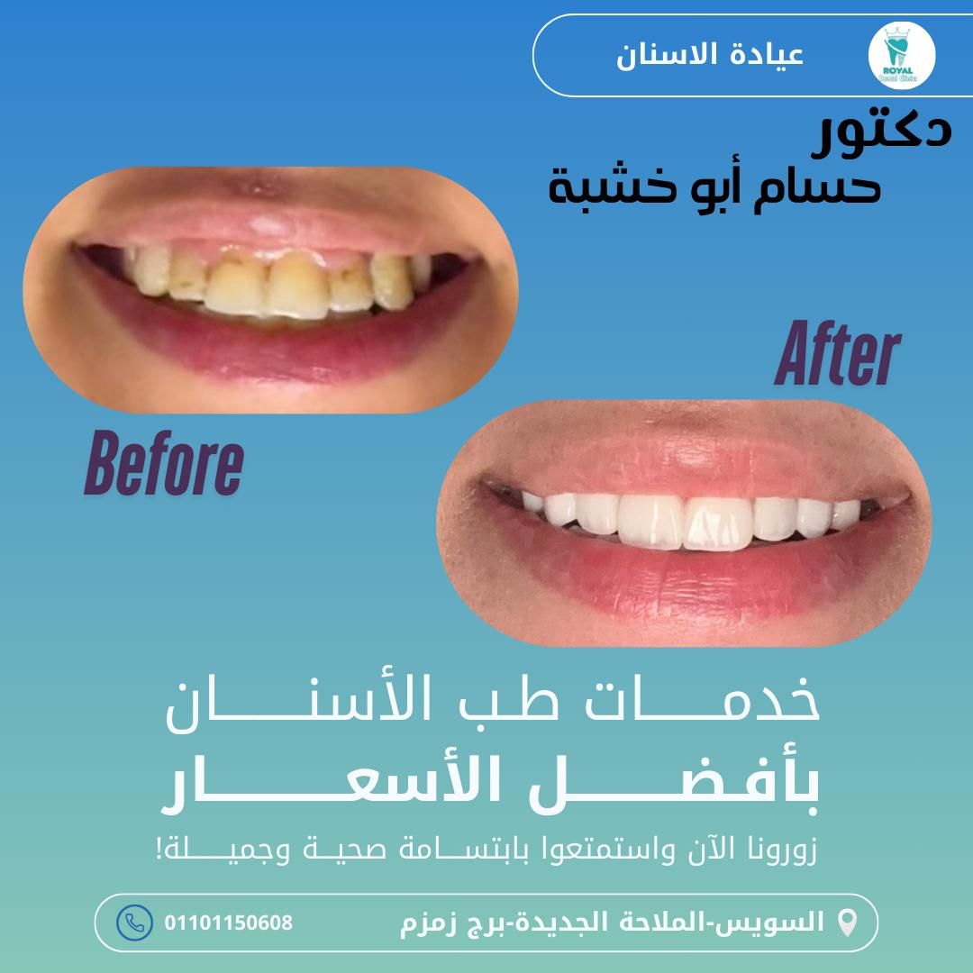 عيادات رويال لطب الاسنان بالسويس - عيادات أسنان في السويس