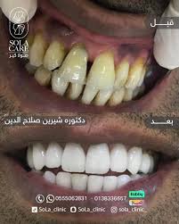 عيادات صولا كير جلدية - ليزر - أسنان ( عيادات شام سابقا) - عيادات في الشرقية