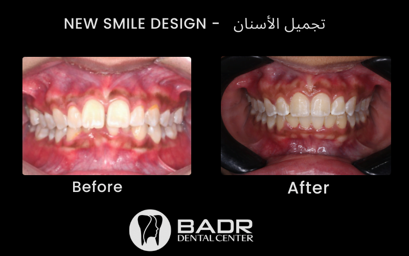 Badr Dental Center (مركز بدر لعلاج وتجميل وزراعة الاسنان) - دكتور أحمد عبدالله بدر - عيادات أسنان في الدقهلية