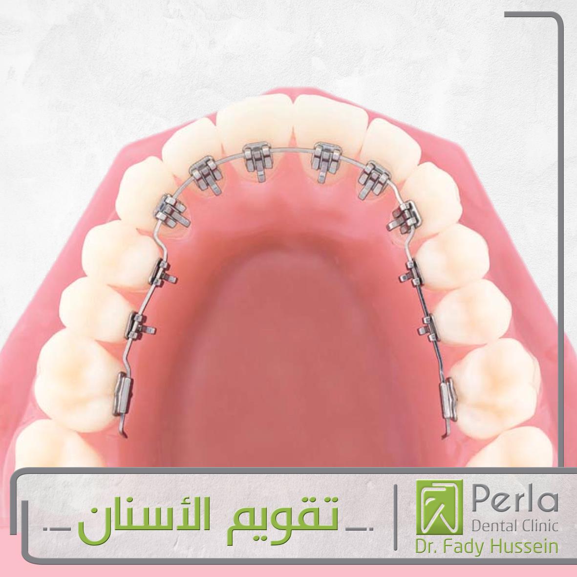 بيرلا لطب الأسنان - عيادات أسنان في الجيزة