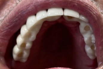 Crown Dental Clinic / د.روماني مجدي الحلواني - عيادات أسنان في المنيا