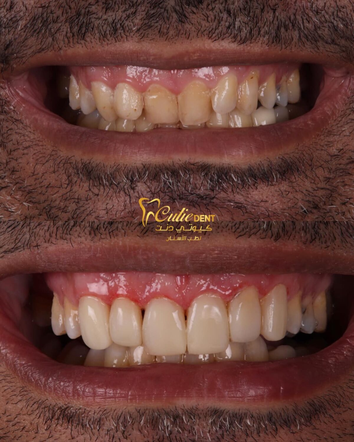 Cutie Dent Center - كيوتي دنت سنتر - عيادات أسنان في السويس