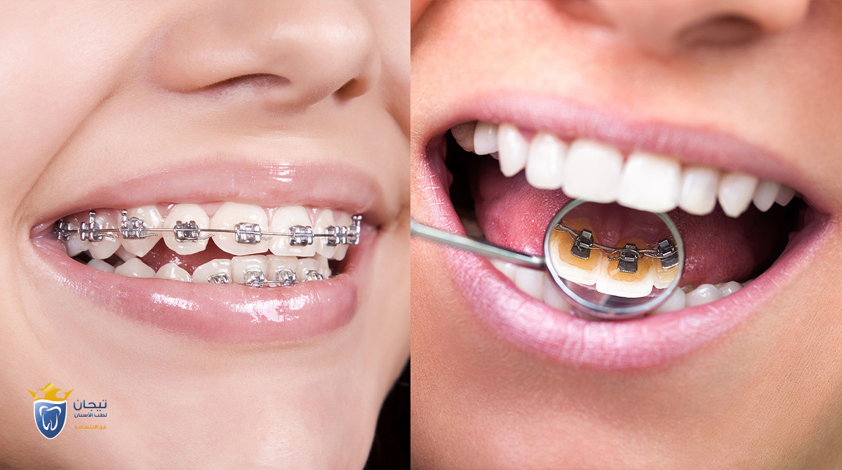 Dental Art Space عيادة د. أحمد سلامة لتجميل و تقويم الاسنان في دمنهور - عيادات في البحيرة