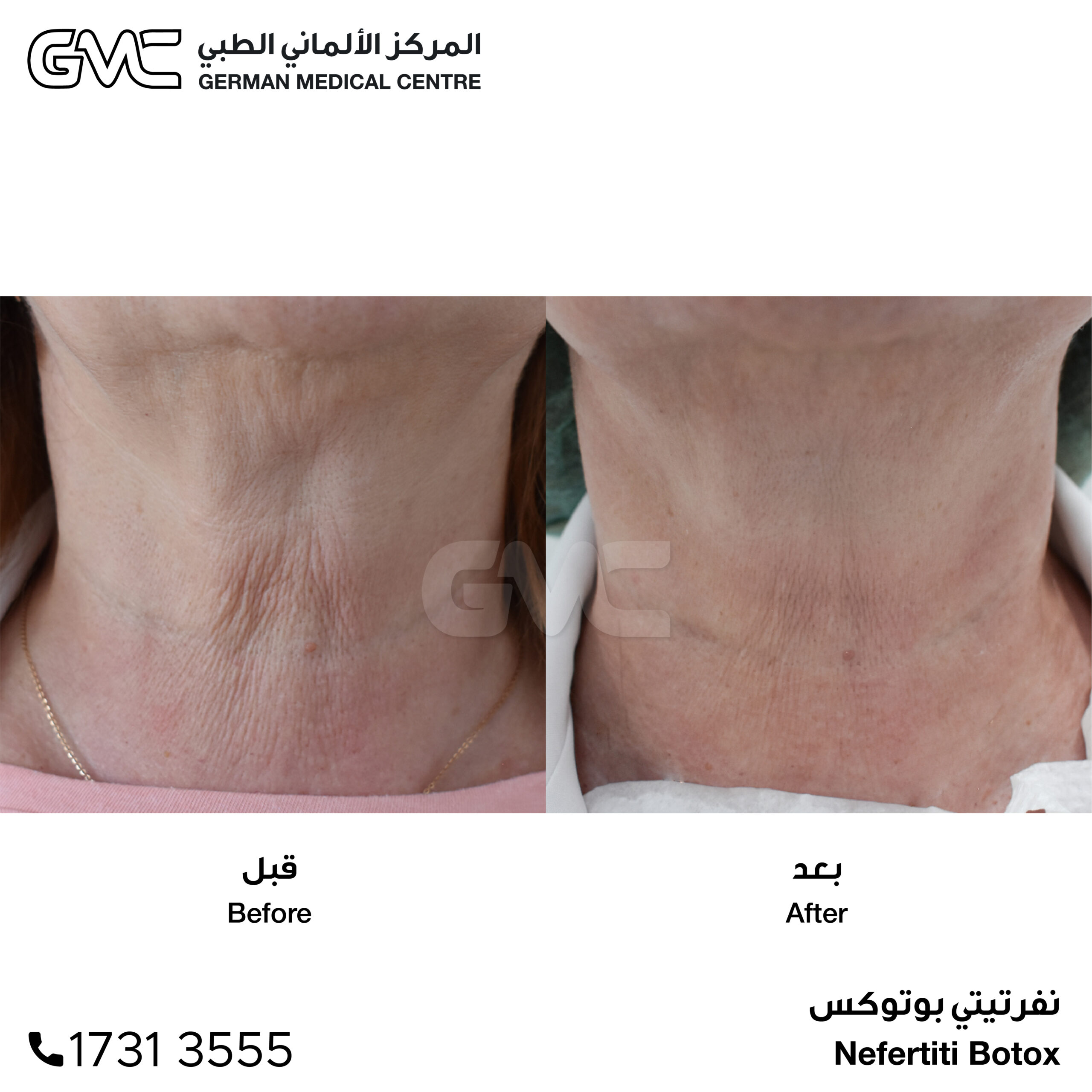 دكتور محمد سلام عيادة جلدية تجميل ليزر بشرة - عيادات جلدية في حولي