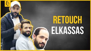 Elkassas Hair Extension القصاص هير فرع فيصل - زراعة الشعر في الجيزة