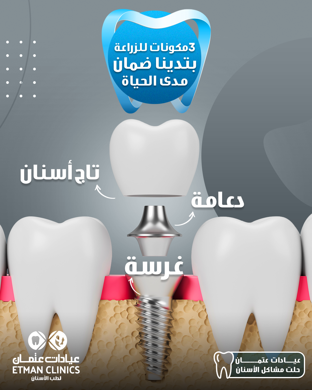 Etman Dental Clinics Centers - مركزعيادات عتمان لزراعة و تجميل الأسنان - عيادات في الدقهلية