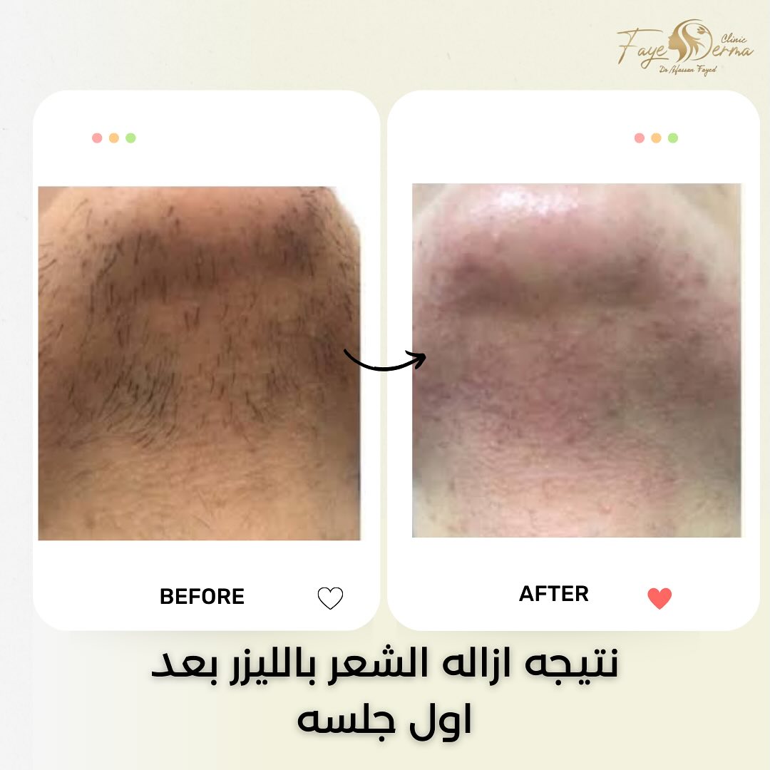 FayeDerma clinic - مراكز تجميل في دمياط