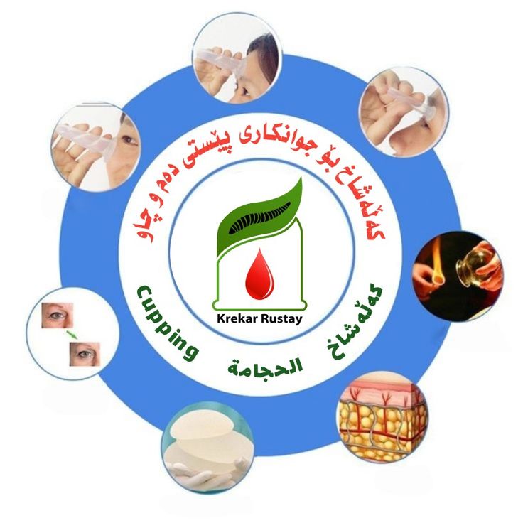 جوانکاری شکۆ - خدمات سيارات في حلبجة