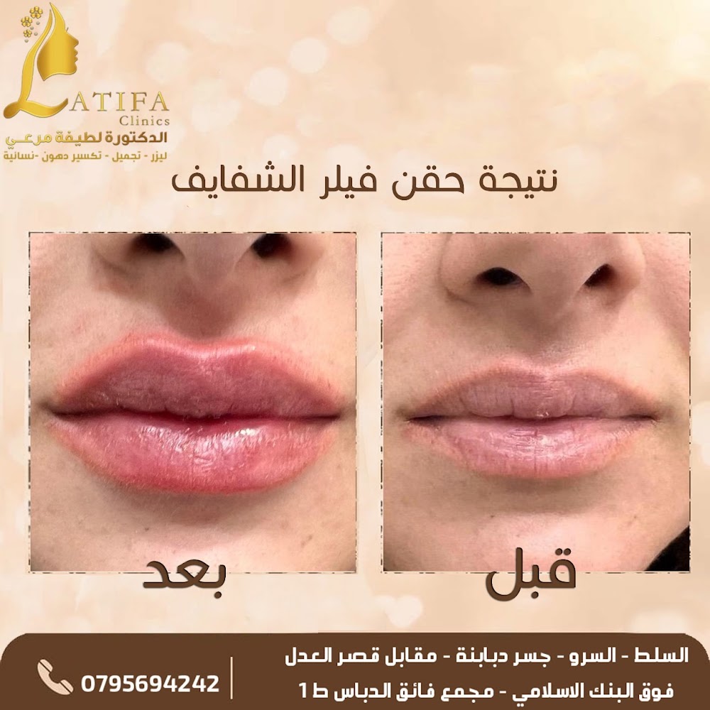 Latifa clinic - عيادات الدكتورة لطيفة للتجميل والليزر - عيادات في البلقاء