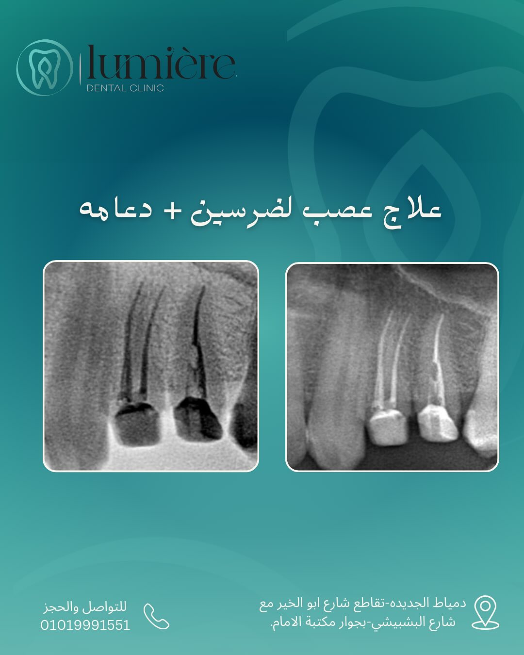 Lumiere dental clinic - عيادات أسنان في دمياط