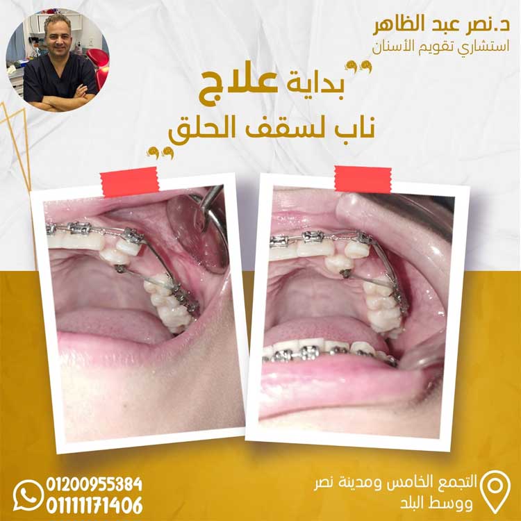 معمل أسنان رزق عزيز رزق - عيادات أسنان في المنوفية