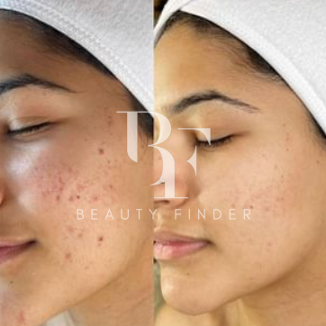 Miracle Aesthetic & Beauty Center - مراكز تجميل في الدوحة