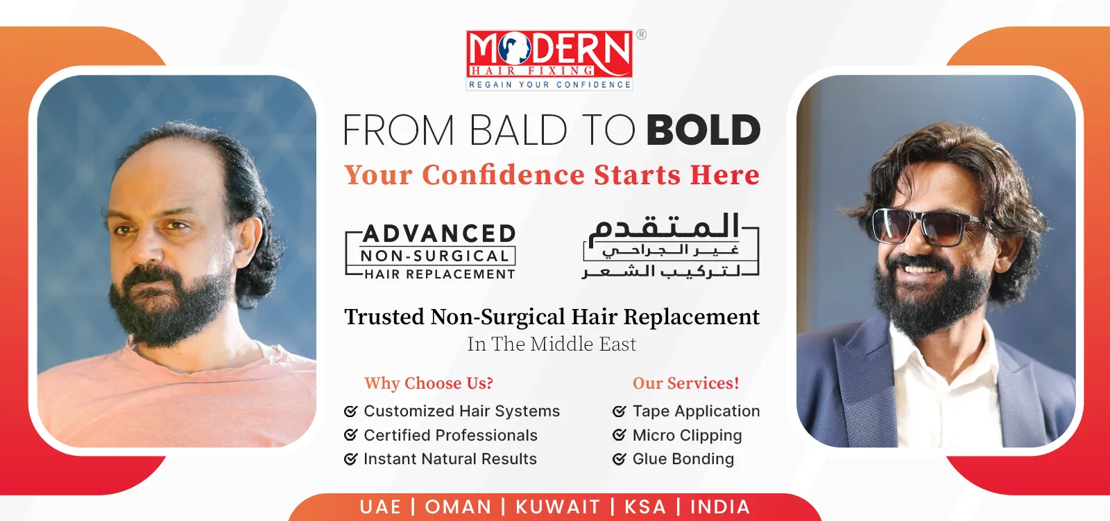 Modern Hair Fixing - Sharjah مودرن لتركيب الشعر - زراعة الشعر في الشارقة