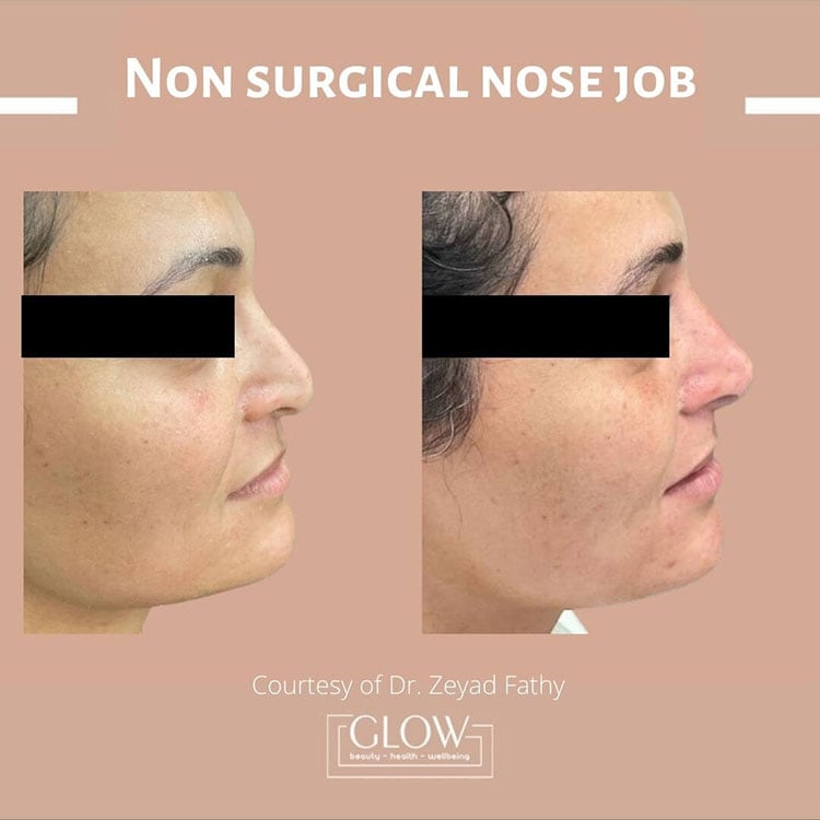 مركز الاسكندرية للتجميل - مراكز تجميل في الإسكندرية