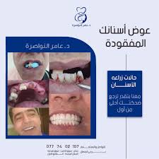 مركز الدكتور عامر النواصره لزراعه الاسنان (فرع جرش) - عيادات في جرش