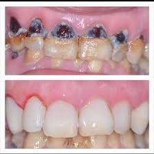 مركز الدكتور سامر رزوق لطب الاسنان - عيادات أسنان في المفرق