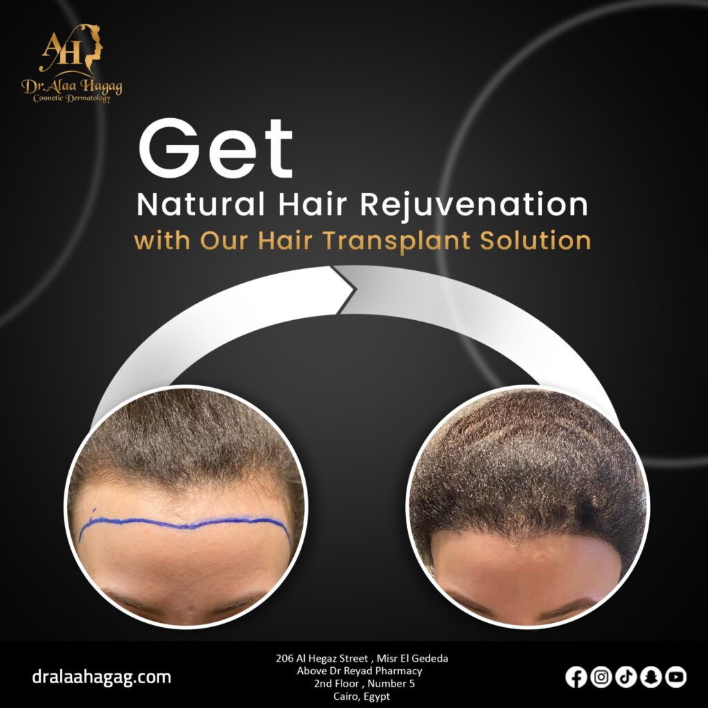 مركز الرحاب التخصصي لعلاج الشعر والبشره - زراعة الشعر في أسيوط