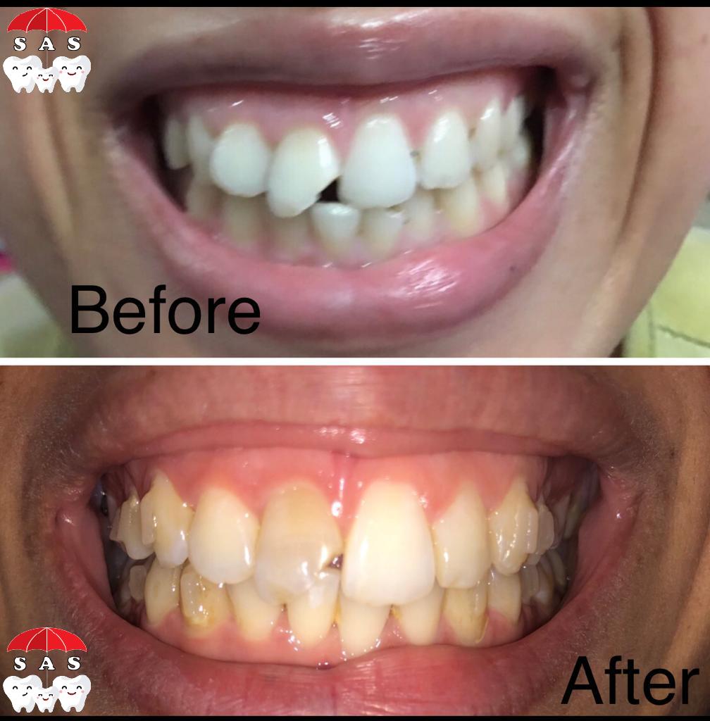 مركز الريدي للاسنان - عيادات أسنان في السويس