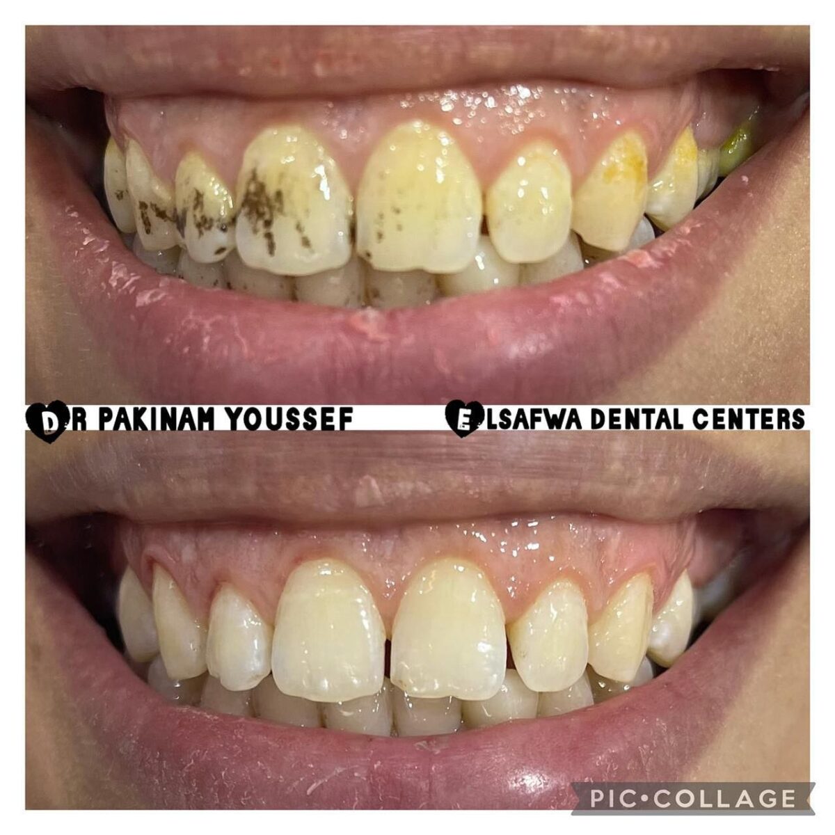 مركز الصفوه للاسنان بورفواد - عيادات أسنان في بورسعيد