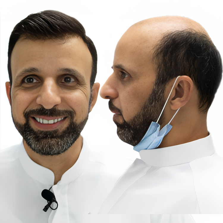 مركز الشخيص لتركيب الشعر - زراعة الشعر في عجمان