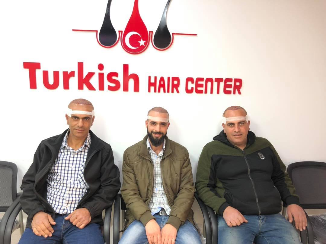 مركز الوطني التركي لزراعة الشعر والتجميل تلعفر - زراعة الشعر في نينوى