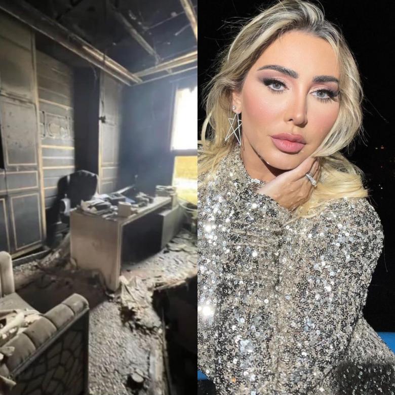 مركز اليساندرو للتجميل - زراعة الشعر في عمّان