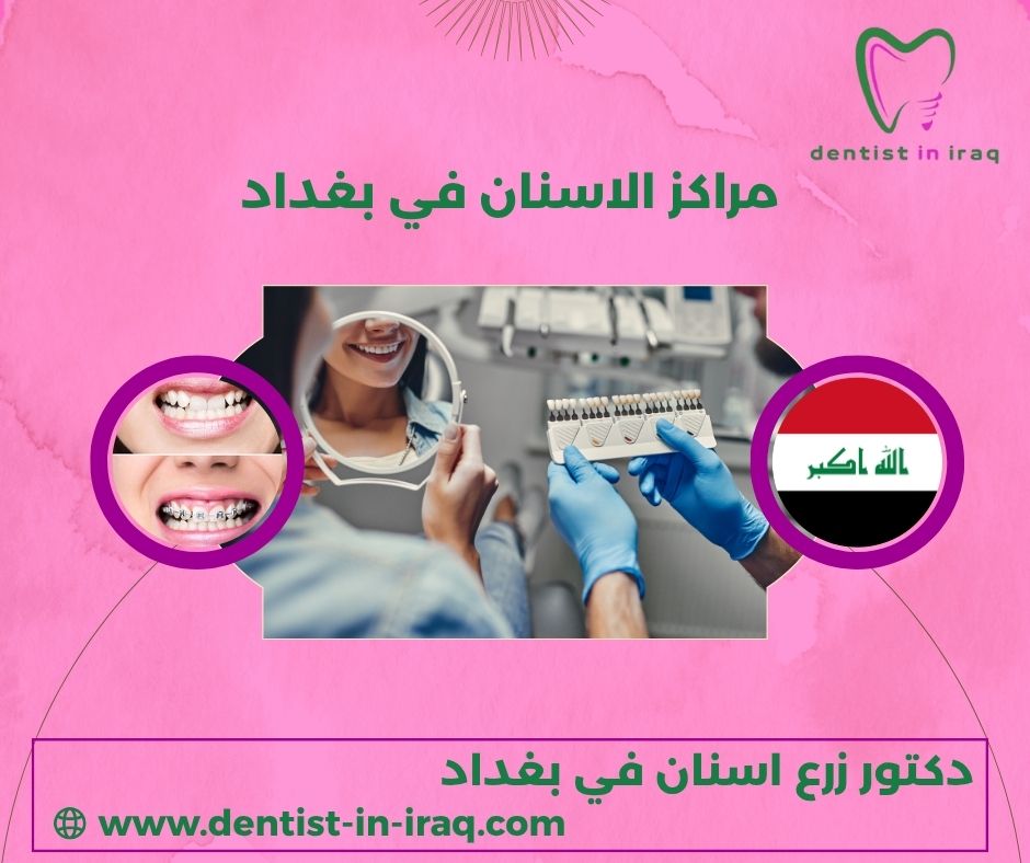 مركز عناية الاسنان - عيادات أسنان في بغداد