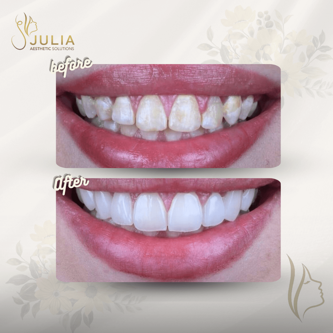 مركز جويس كلينيك للتجميل والليزر والبشرة - مراكز تجميل في الأقصر