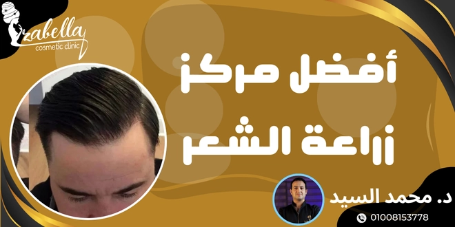 مركز جيتو للعناية و زراعة الشعر - زراعة الشعر في بغداد