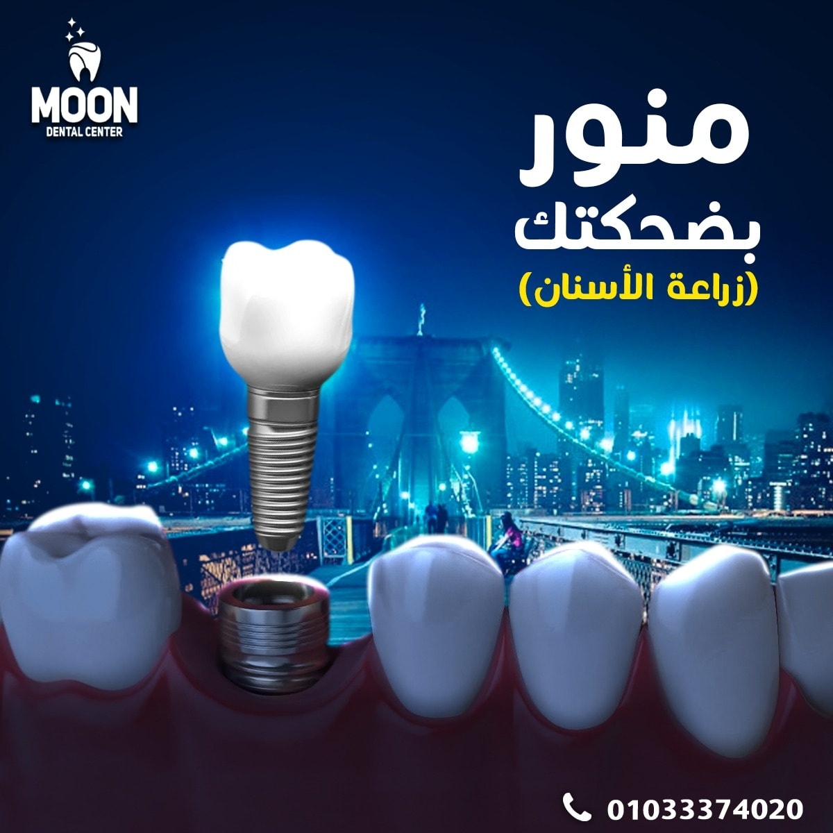 مركز مون لطب الاسنان - عيادات أسنان في بنها