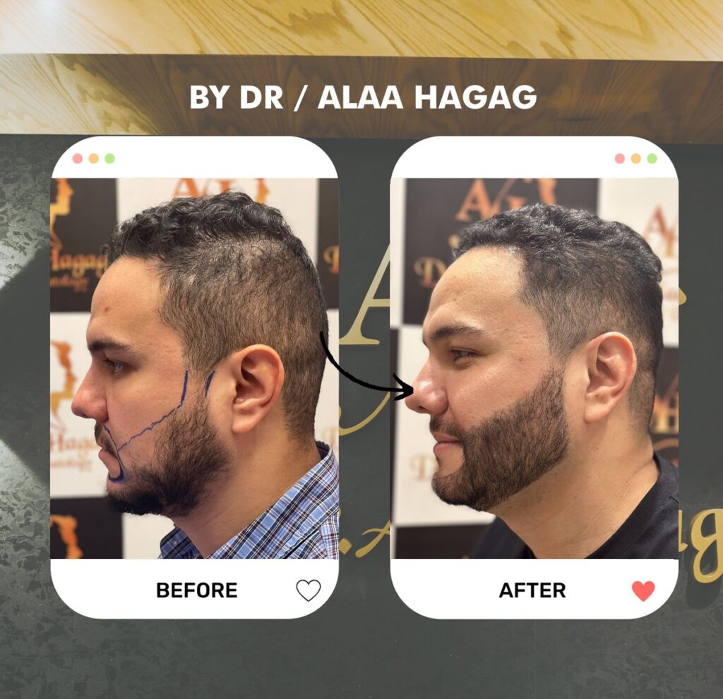 متنزه حي المعلمين - زراعة الشعر في ذي قار